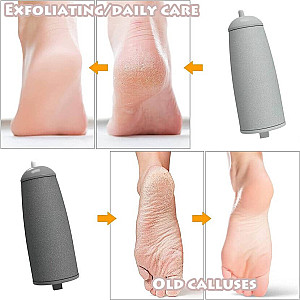 Callus Remover Pedicure (rechargeable)